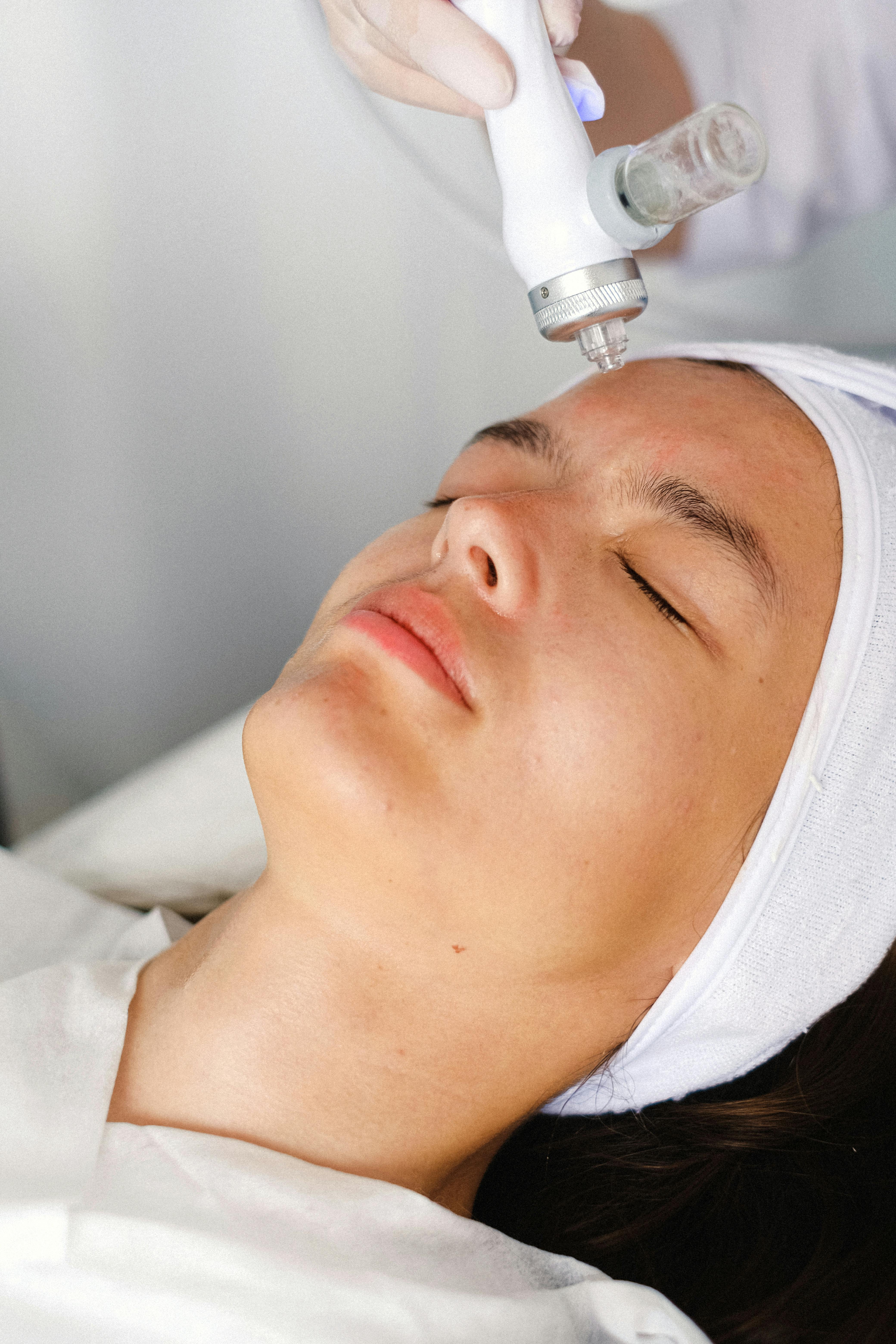 Forehead lines softening med spa result example